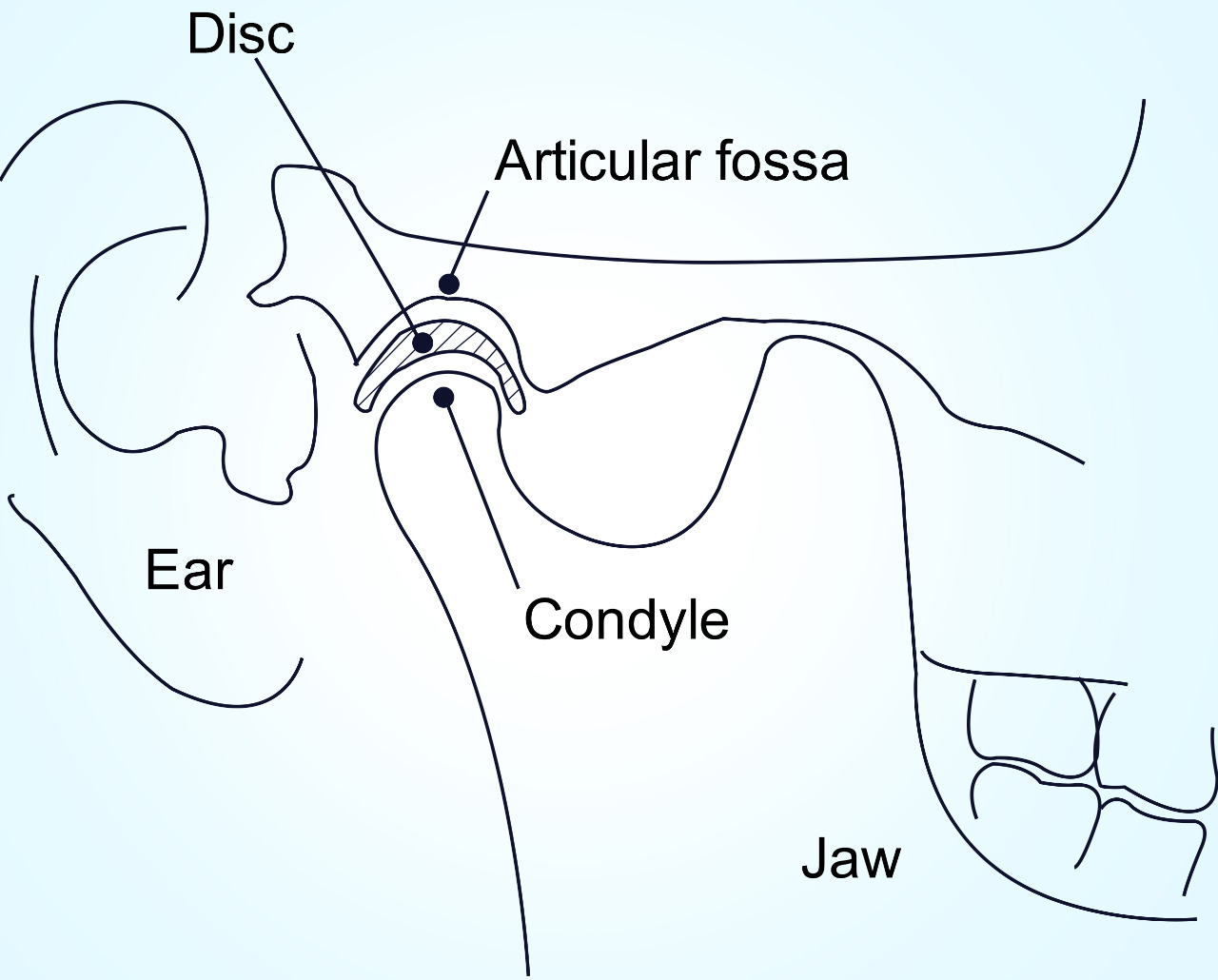 Occlusal Splints